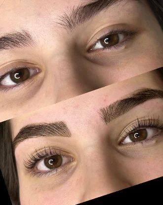 Sourcils et cils avant et après un brow lift